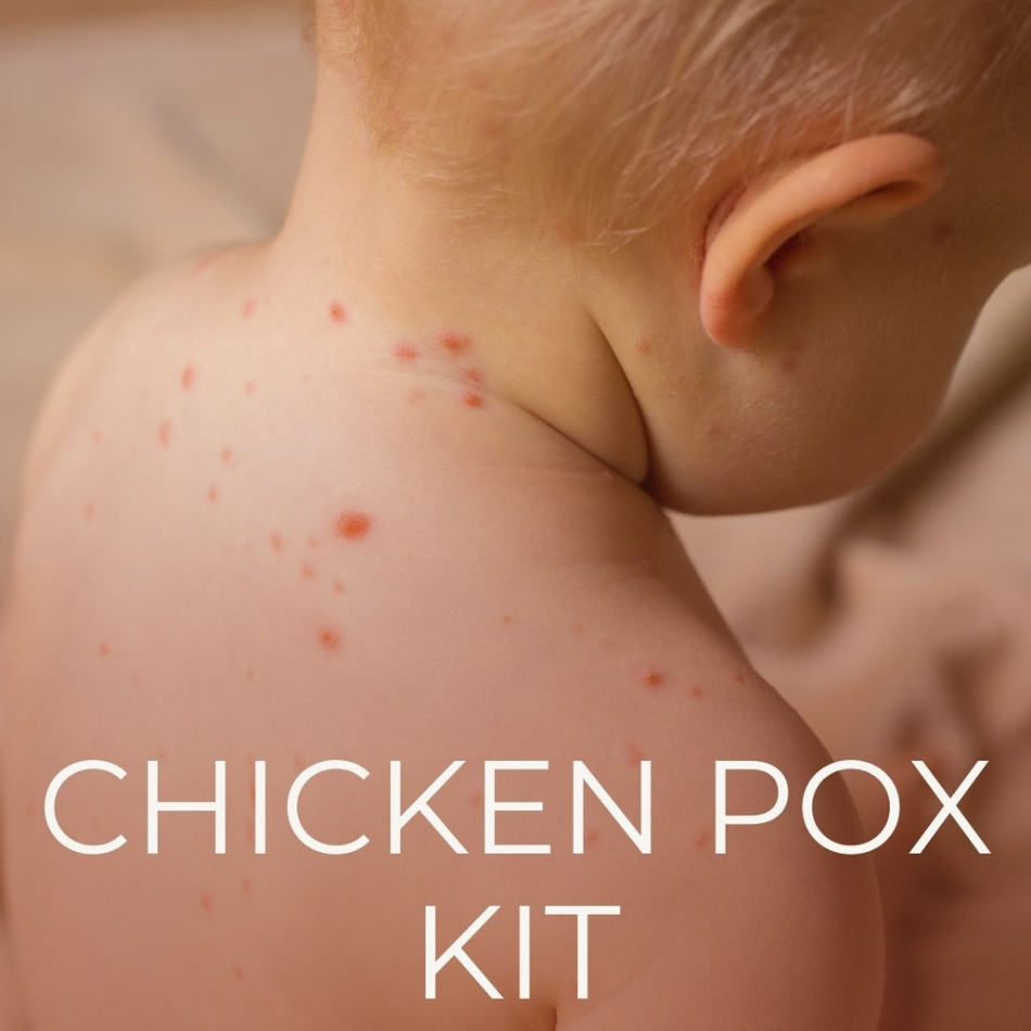 Chicken Pox Kit (The Remedy Room)